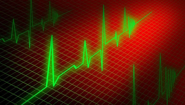 stock image Ecg diagram