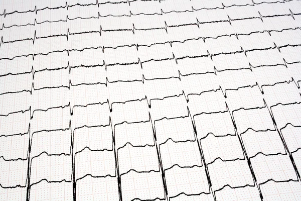 EKG - EKG'sini grafiği — Stok fotoğraf