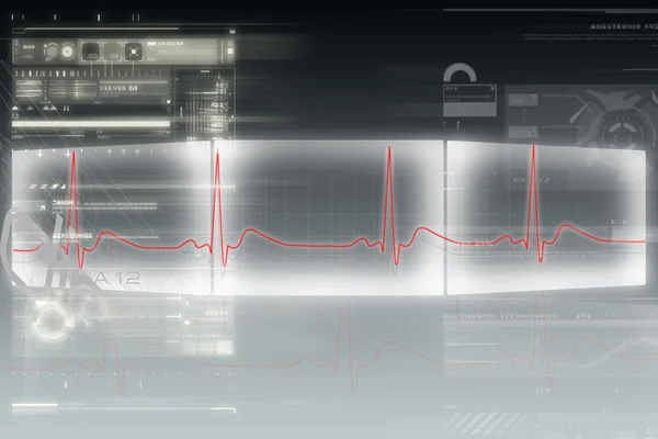 Ilustração digital da tela do monitor cardíaco com sinal de batimento cardíaco normal — Fotografia de Stock