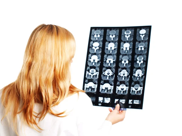 Женщина-врач изучает рентгеновские снимки на белом — стоковое фото