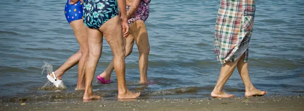 stock image Senior women with cellulite