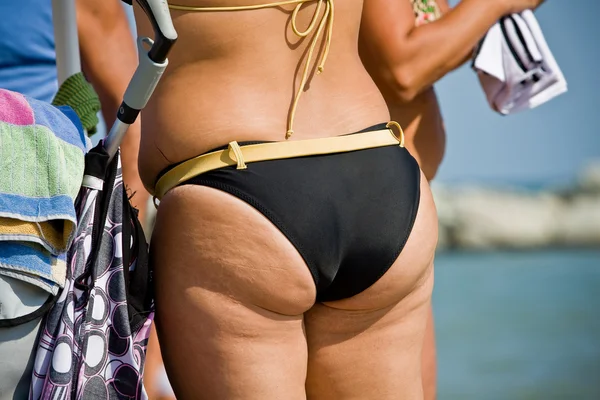 Adult women tushie with cellulite — Stock Photo, Image