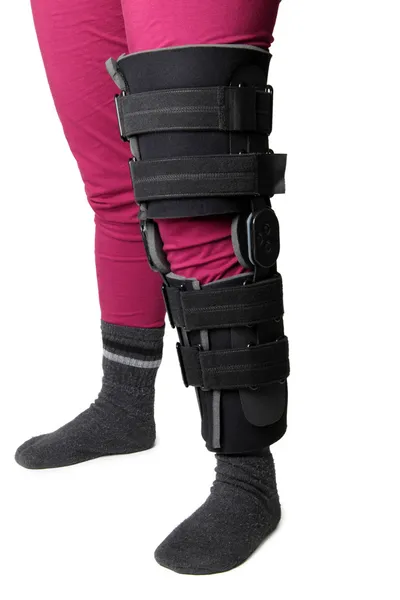 Lesión de rodilla — Foto de Stock