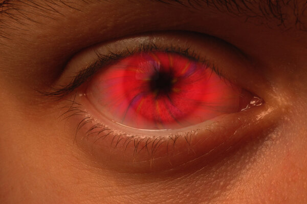 Red Vortex in an eyeball