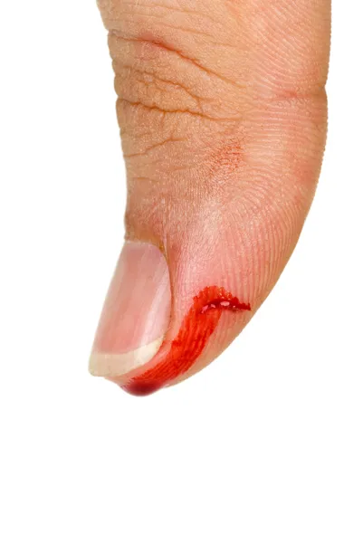 Кровавый палец большого пальца — стоковое фото