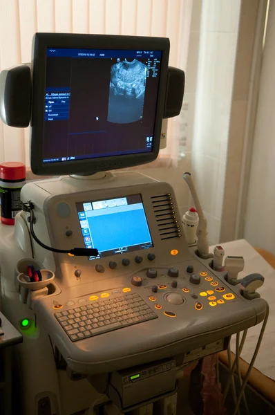 Ultrasound diagnostics Equipment — Stock Photo, Image