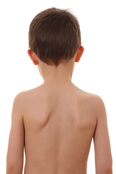 La espalda del niño — Foto de Stock