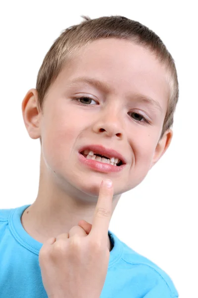 Зубы человека — стоковое фото