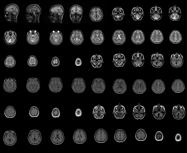 Ct computador tomografia cérebro — Fotografia de Stock