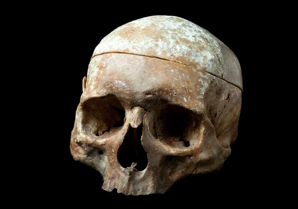 Ludzka czaszka odizolowana na czarnym tle — Zdjęcie stockowe