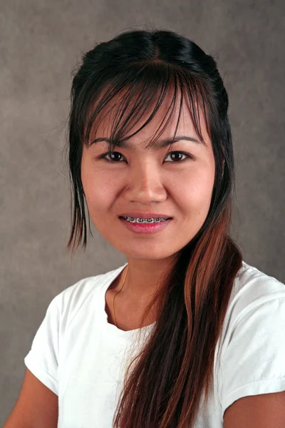 Тайская девушка с брекетами — стоковое фото