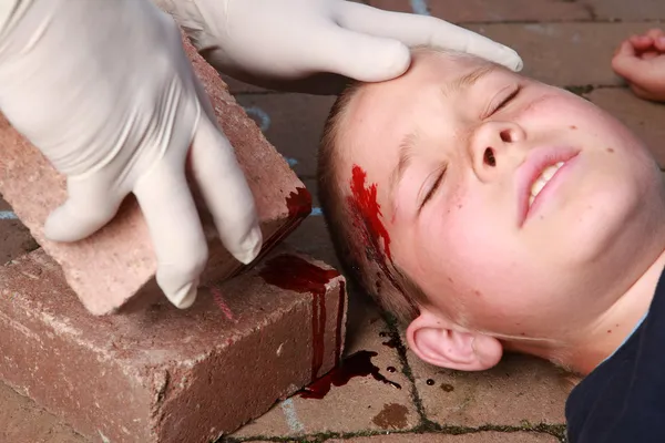 Niño con lesión en la cabeza — Foto de Stock