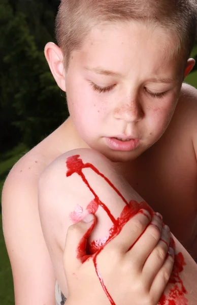 Yaralı diz ile genç çocuk — Stok fotoğraf
