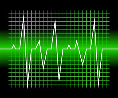 Graphic of digital sound wave clipart