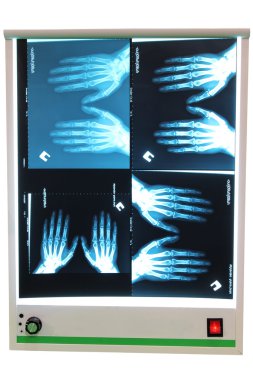 X-ray photograph clipart