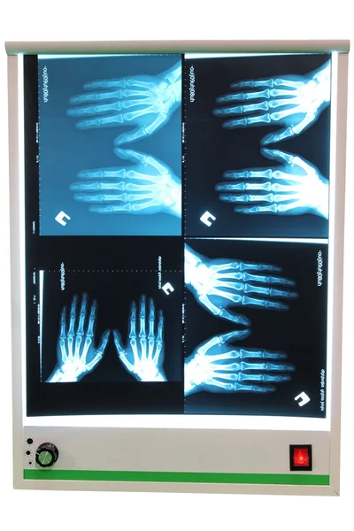 Рентгеновская фотография — стоковое фото