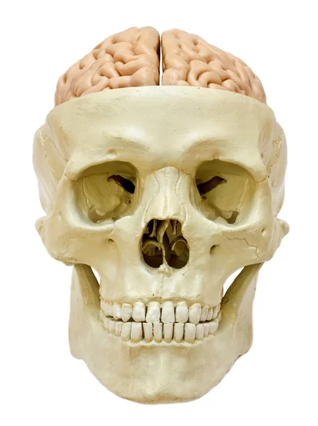 Cráneo con cerebro visible — Foto de Stock