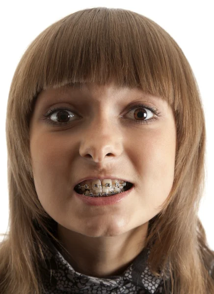 Chica sonríe con soporte en los dientes — Foto de Stock