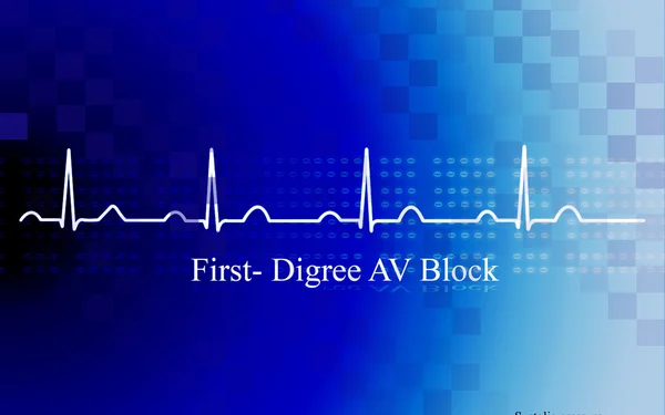 АВ-блок першого ступеня при коронарних захворюваннях — стокове фото