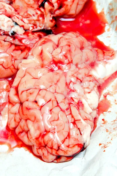 Beyin — Stok fotoğraf