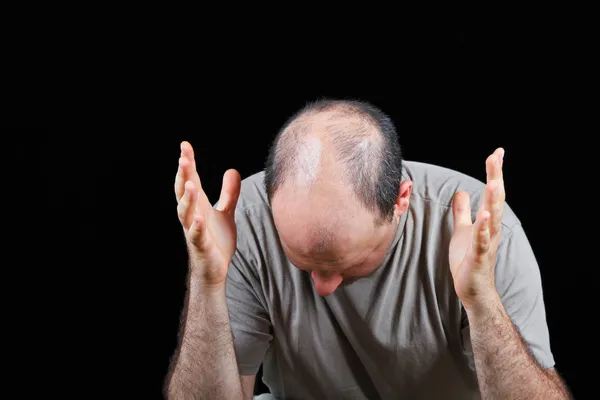 Perder o cabelo — Fotografia de Stock