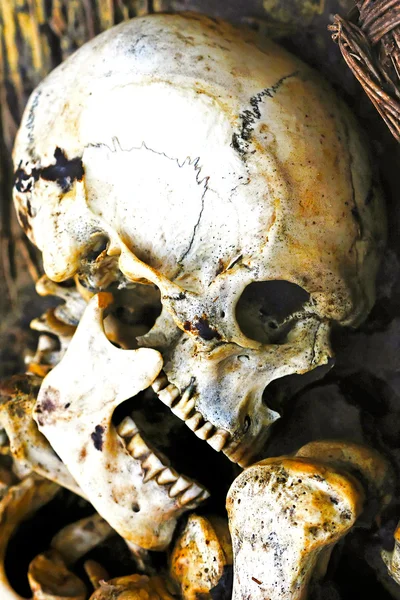 人間の骨 — ストック写真