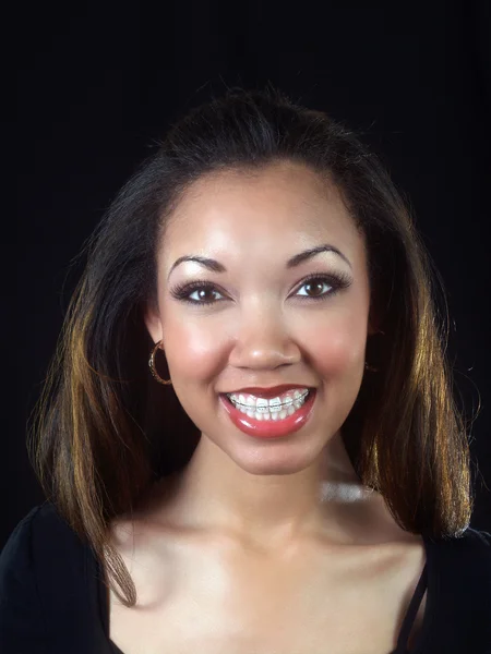 Diş teli ile gülümseyen genç bir Afrikalı-Amerikalı kadın — Stok fotoğraf
