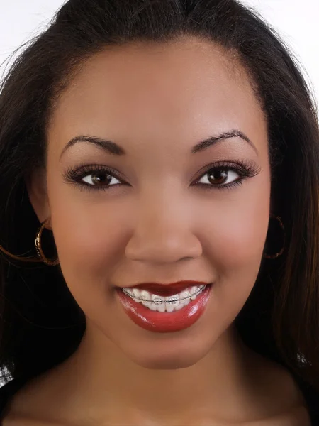 Leende ung svart kvinna med hängslen övre tänder — Stockfoto