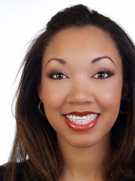 Jonge zwarte vrouw met grote glimlach bretels bovenste tanden — Stockfoto