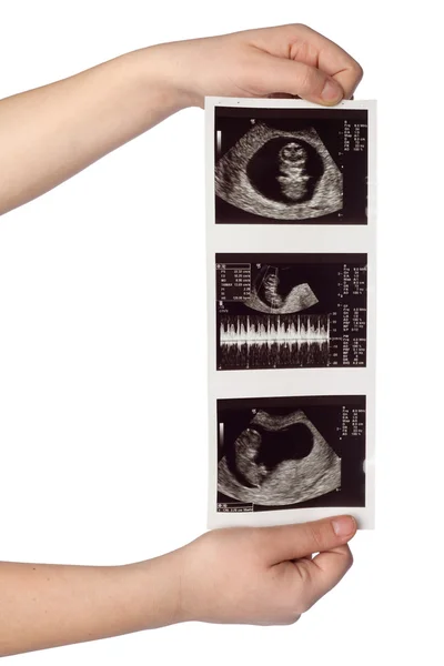 Immagini ad ultrasuoni — Foto Stock