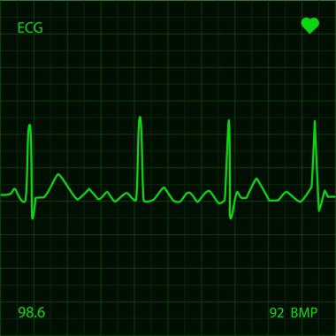 Heart Monitor clipart