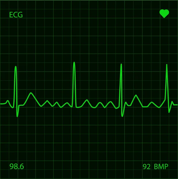 Moniteur cardiaque — Image vectorielle
