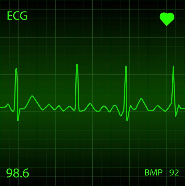 Heart Monitor — Stock Vector