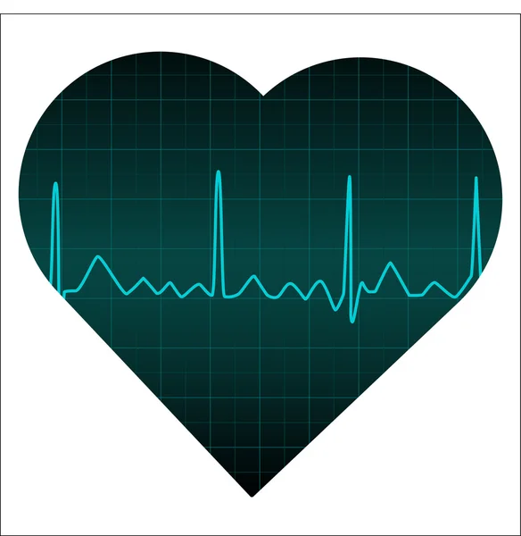 Monitor cardíaco — Vetor de Stock
