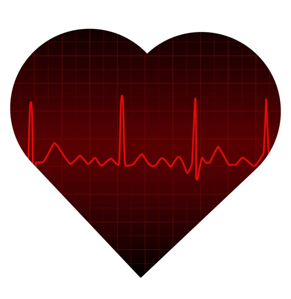 Monitor cardíaco —  Vetores de Stock