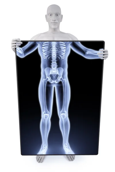 Statua radiografia — Foto Stock