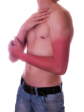 Man Sunburned hands clipart