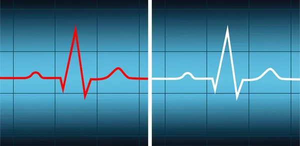 Cardiograms — Stok Vektör