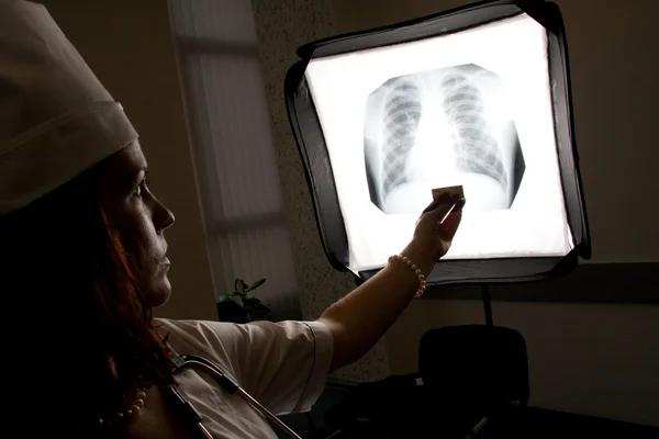 Arzt mit Brust-Röntgen — Stockfoto