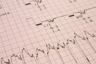 Kardiyoloji test sonuçları