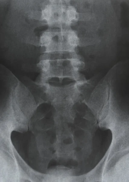 X-ray — стоковое фото