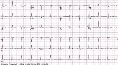 12-lead Electrocardiogram clipart