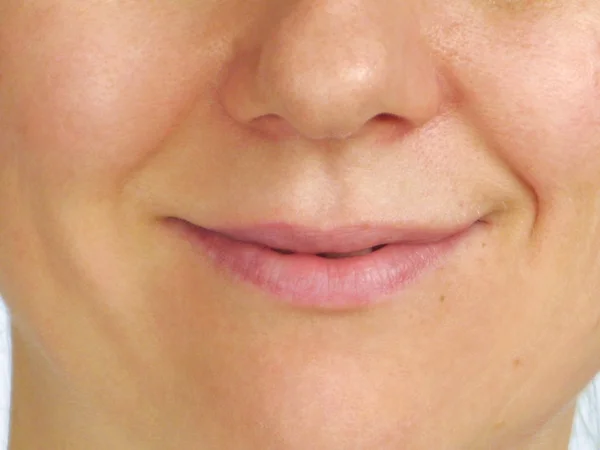 La corrección de las arrugas - la mitad del rostro —  Fotos de Stock