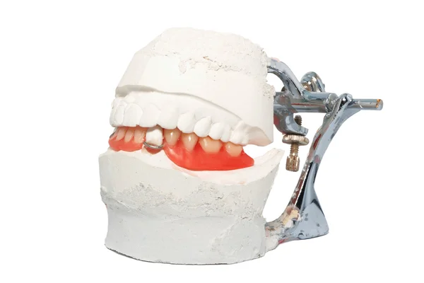Prótese dentária — Fotografia de Stock