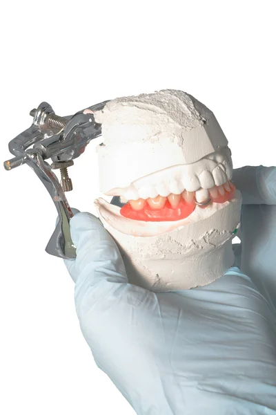 Diş Protezi — Stok fotoğraf