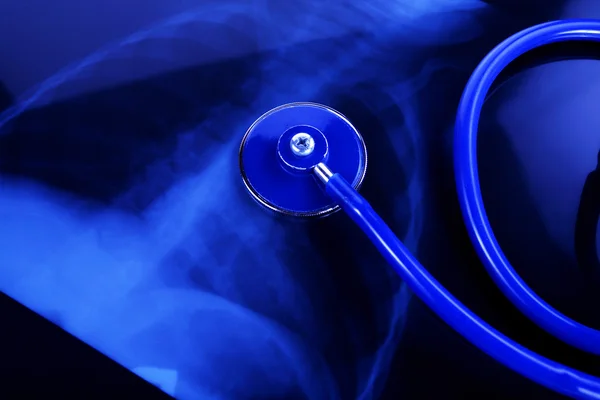 Stetoskop xray üzerinde — Stok fotoğraf