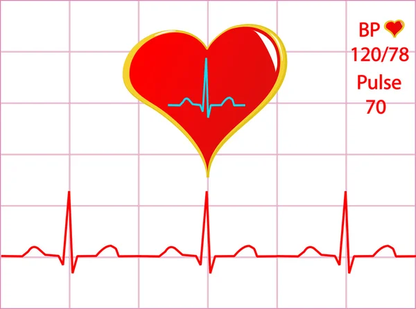 Μια υγιή καρδιά απεικόνιση — Διανυσματικό Αρχείο