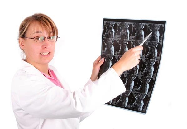 stock image Young women doctor with x-ray image