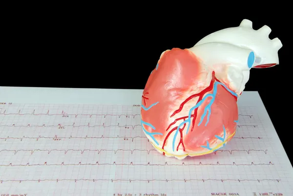 Bir EKG kalp — Stok fotoğraf