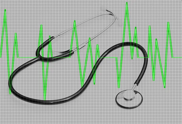 EKG grafikonon sztetoszkóp — Stock Fotó